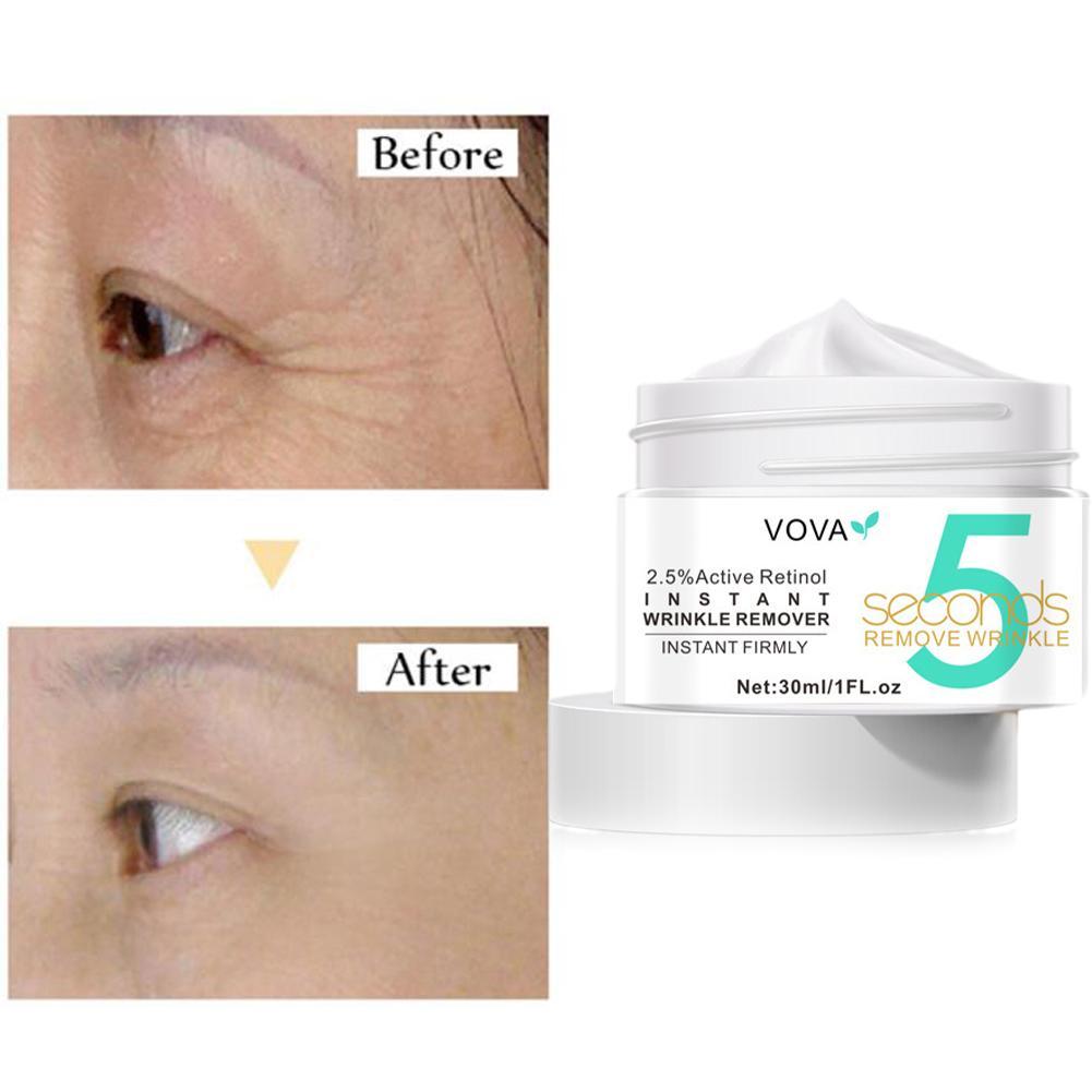 2.5% Active Retinol Eye Cream  - Milk Thistle Silymarin 评论和价格
